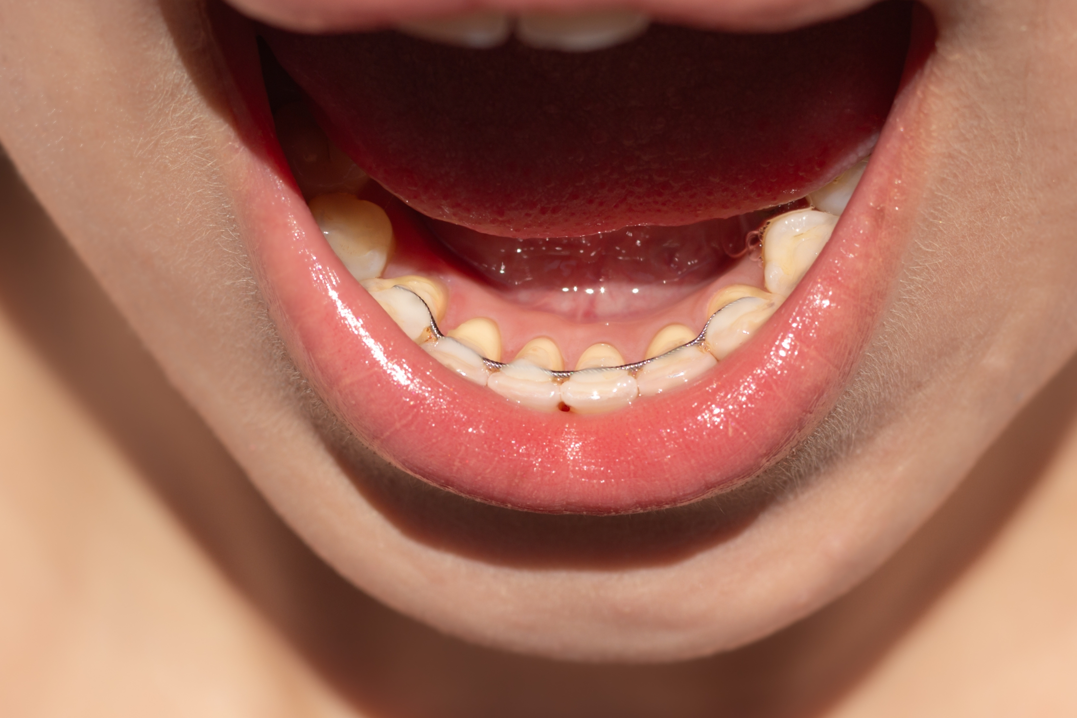 orthodontist greenwood in